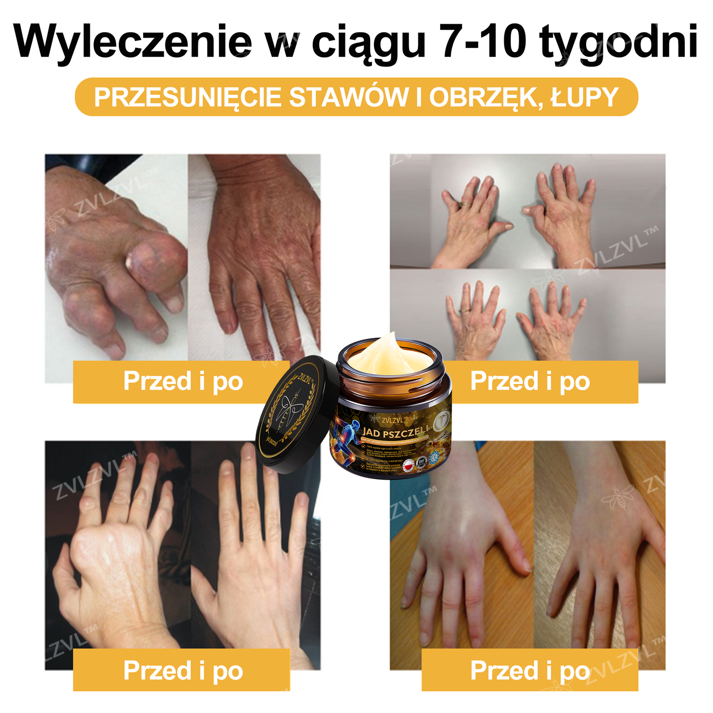 🎁 Oferujemy dodatkowy 50% rabat! Zostań zdrowszy i pełen energii. Zacznij łagodzić stany zapalne i ból już teraz, ponieważ kolejną okazję będziesz miał dopiero w przyszłym roku.