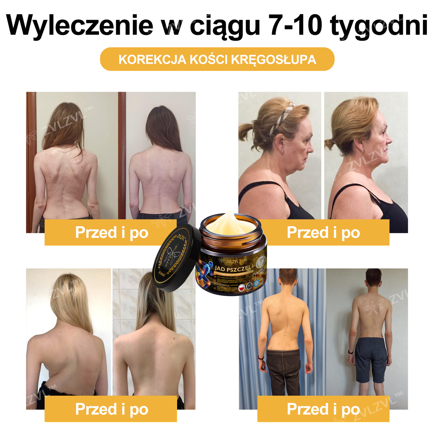 🎁 Oferujemy dodatkowy 50% rabat! Zostań zdrowszy i pełen energii. Zacznij łagodzić stany zapalne i ból już teraz, ponieważ kolejną okazję będziesz miał dopiero w przyszłym roku.