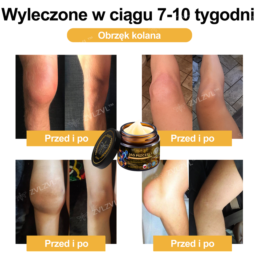 🎁 Oferujemy dodatkowy 50% rabat! Zostań zdrowszy i pełen energii. Zacznij łagodzić stany zapalne i ból już teraz, ponieważ kolejną okazję będziesz miał dopiero w przyszłym roku.