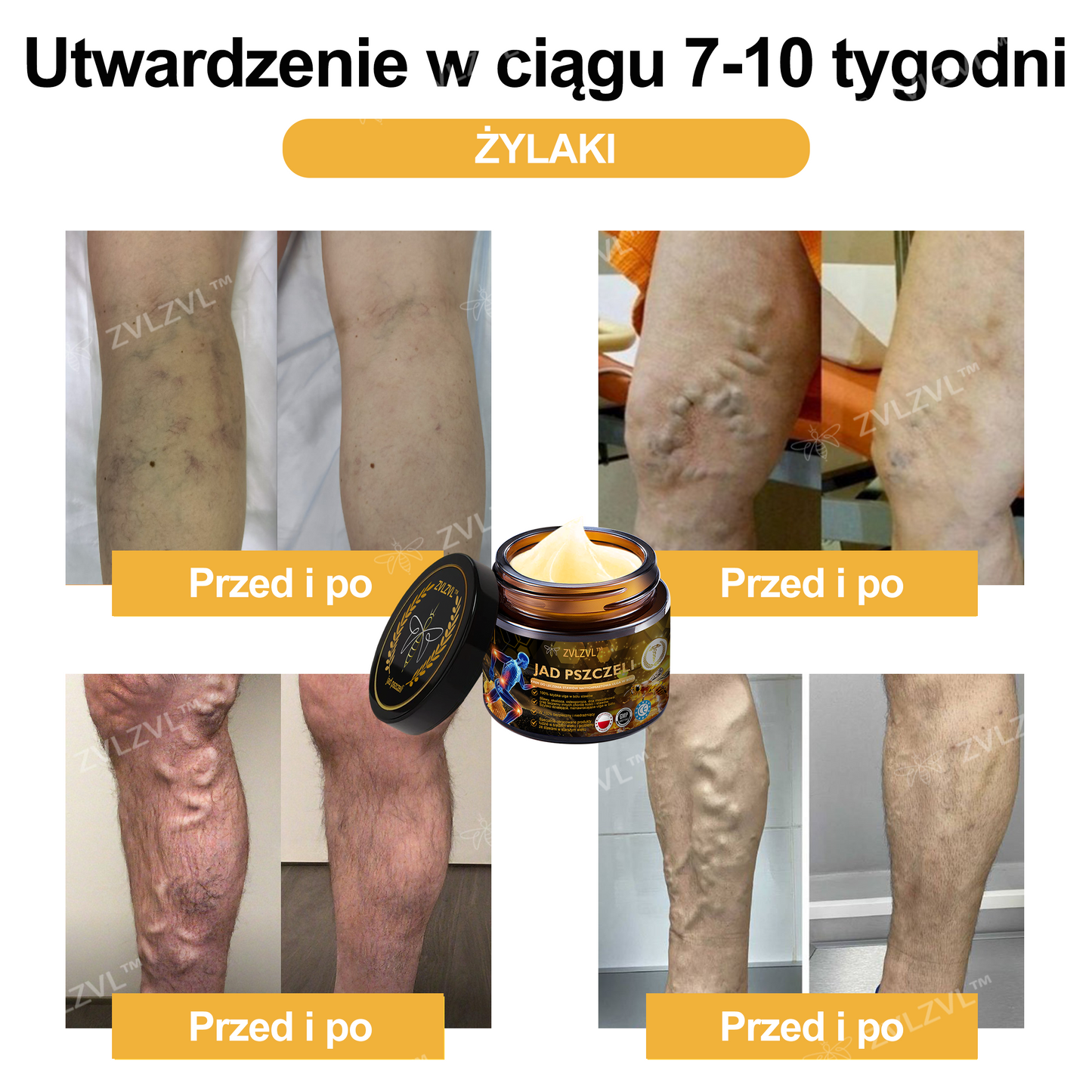 🎁 Oferujemy dodatkowy 50% rabat! Zostań zdrowszy i pełen energii. Zacznij łagodzić stany zapalne i ból już teraz, ponieważ kolejną okazję będziesz miał dopiero w przyszłym roku.