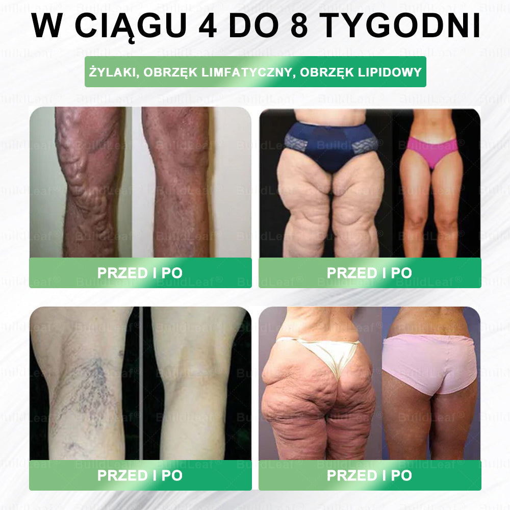 🎁 Oferujemy dodatkowy 30% rabat! Zostań zdrowszy i pełen energii. Ponieważ kolejną okazję będziesz miał dopiero w przyszłym roku.